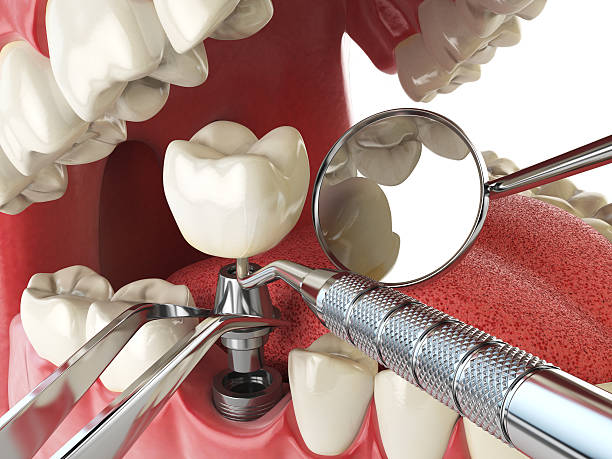 Best Emergency Broken Tooth Repair in Orlinda, TN
